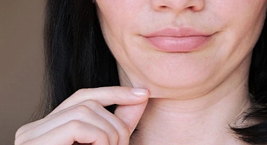 Gıdı problemine doğal çözüm