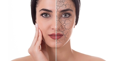 Sıcak Suyla Duş Almak Cildi Kurutabilir