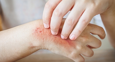 Yaz Aylarında Cildimizi Tehdit Eden 8 Önemli Hata!