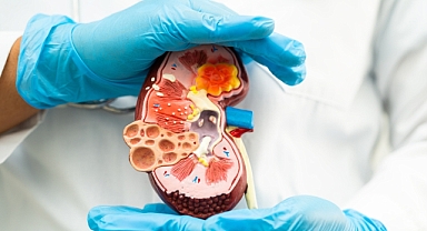 Çocuklarda kalıcı böbrek hasarına neden olabilir!