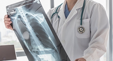 Kemik Kaynaklı Tümörlerde Erken Teşhis Hayat Kurtarıyor