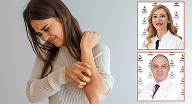 Sedef Hastalığı ve Sedef Romatizmasına Dikkat