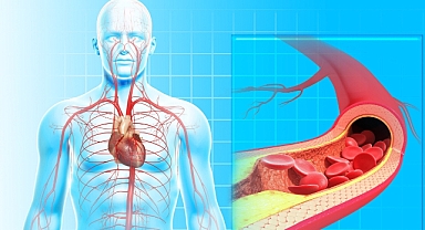 Boynumuzdaki Sessiz Tehdit: Şah Damarı Tıkanıklığı