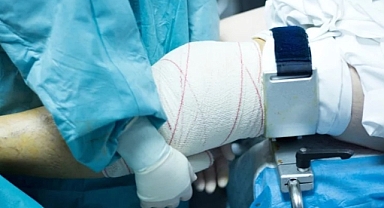 Ortopedi servisinde skandal: 75 hastanın sağlam kemiğine platin taktılar