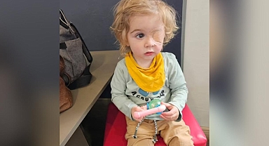 Sevimli bebek bir öpücükle kör oldu!
