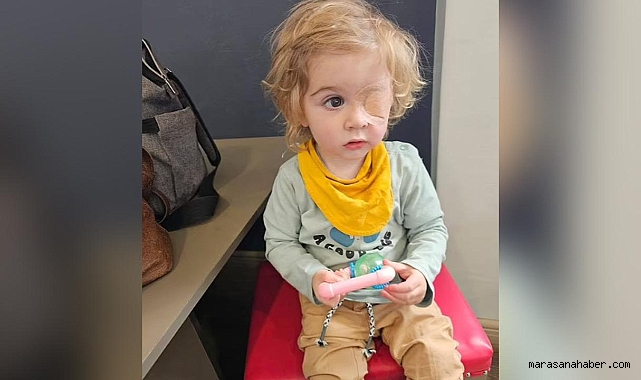 Sevimli bebek bir öpücükle kör oldu!