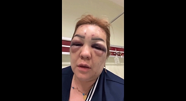 Kahramanmaraş'ta botoks faciası! Kadın Hastanelik Oldu!
