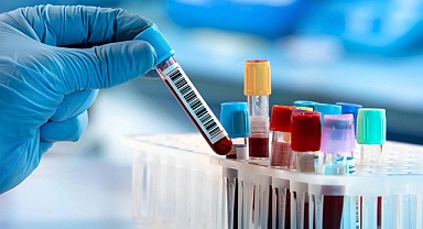 Kahramanmaraş’ta Doktorlara Test Sınırı! Artık Her Tahlili Yazamayacaklar