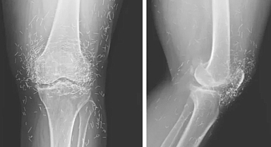 Dizinde yüzlerce altın iplik bulundu!