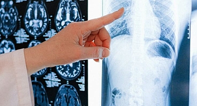 Dünyada Bir Elin Parmaklarını Geçmeyen vaka! Kahramanmaraşlı Doktorlardan Tıp Literatürüne Geçecek Başarı