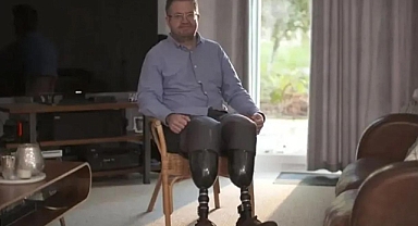 Kendi bacaklarını kesen cerrah hapse atıldı!