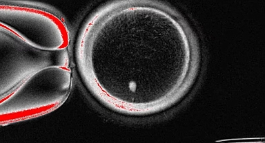 Tıpta Devrim: Deri Hücresinden Yumurta Hücresi Üretildi