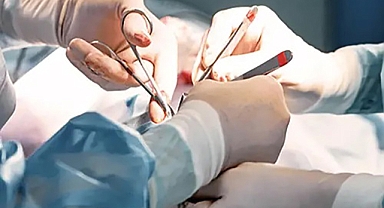 Kahramanmaraş’ta Şaşırtan Olay! Çocuğun Burnundan Zeytin Çekirdeği ve Pipet parçası çıktı!