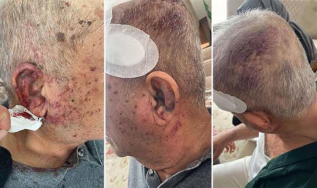 Kahramanmaraş'ta yaşlı adam darp ve gasp edildi!