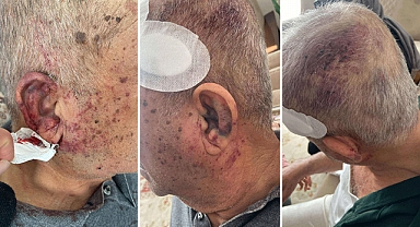 Kahramanmaraş'ta yaşlı adam darp ve gasp edildi!