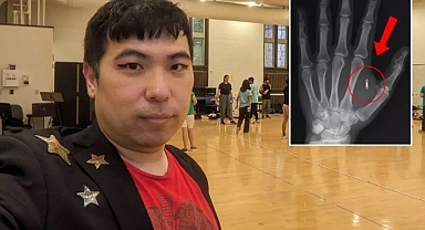 Sihirbaz, Eline Yerleştirdiği Mikroçipin Şifresini Unuttu: Kendi Teknolojisine Erişemiyor