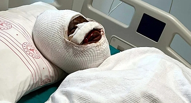 Eşini koli bandıyla bağlayıp başından aşağı kezzap döktü!