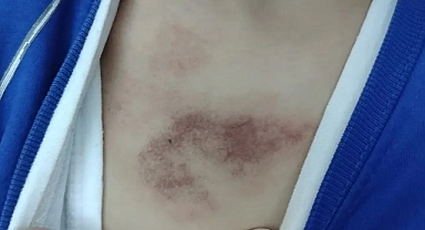 Kreşte 3 yaşındaki çocuğa istismar ve darp iddiası!