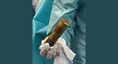 Şaka değil gerçek! Adamın makatından top mermisi çıktı