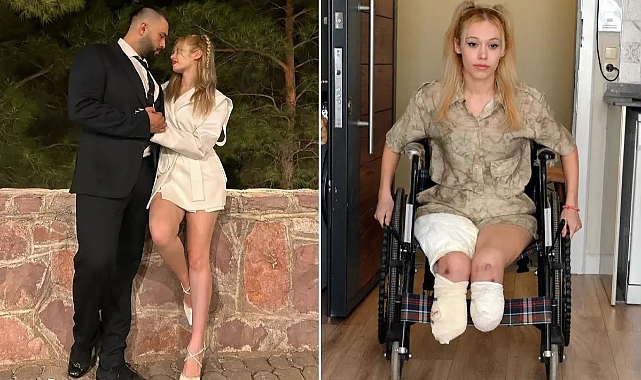 Evlilik Yıl Dönümünde İki Bacağını Kaybeden İrem Karatutlu’dan Tahliye Kararına Tepki!