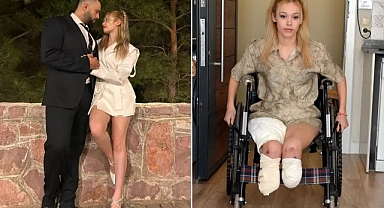 Evlilik Yıl Dönümünde İki Bacağını Kaybeden İrem Karatutlu’dan Tahliye Kararına Tepki!