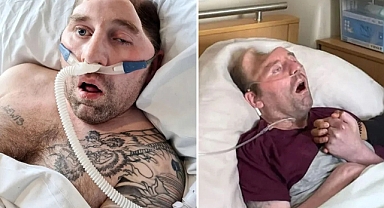 Yumruk darbesiyle bu hale geldi! 