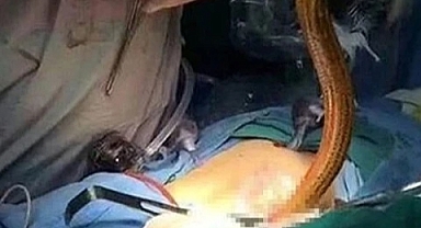 Makatından vücuduna yılan balığı girdi!