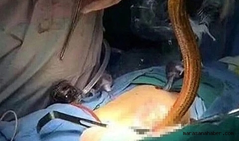 Makatından vücuduna yılan balığı girdi!