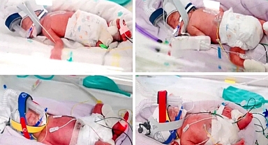 Tek Yumurtadan Dördüz Mucizesi: Anne 8 Çocuk Sahibi Oldu