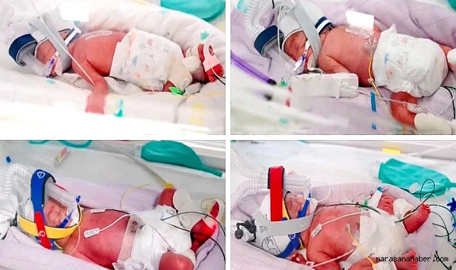 Tek Yumurtadan Dördüz Mucizesi: Anne 8 Çocuk Sahibi Oldu
